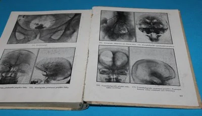 Klinická roentgenologie a radiologie